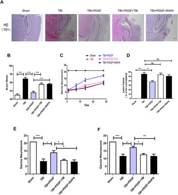 Platelet derived growth factor promotes the recovery of traumatic brain injury by inhibiting endoplasmic reticulum stress and autophagy-mediated pyroptosis